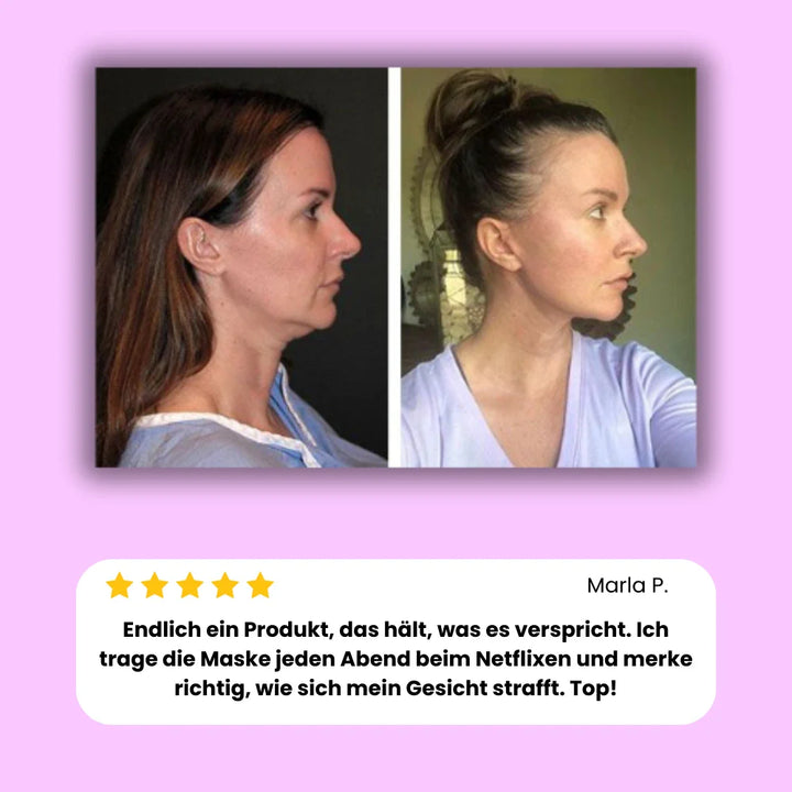 Vizora Kinnmaske