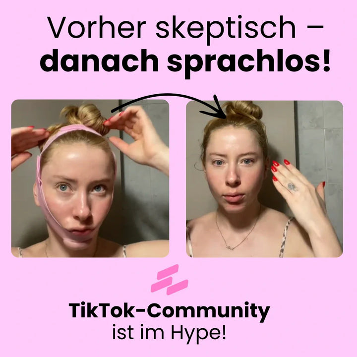 Vizora Kinnmaske