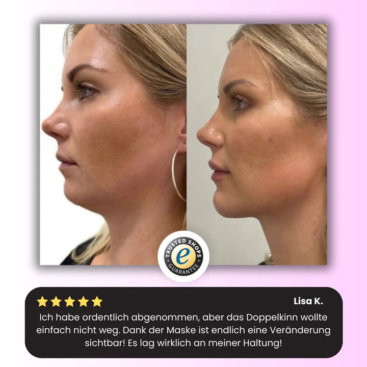 Vizora Kinnmaske