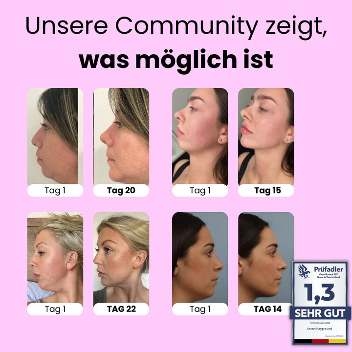 Vizora Kinnmaske